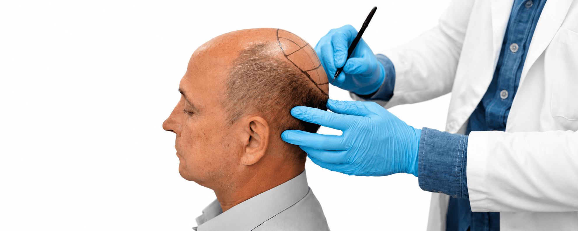 Dermatologist in Gachibowli