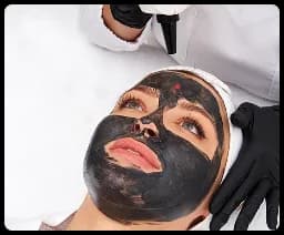 Carbon Peel
